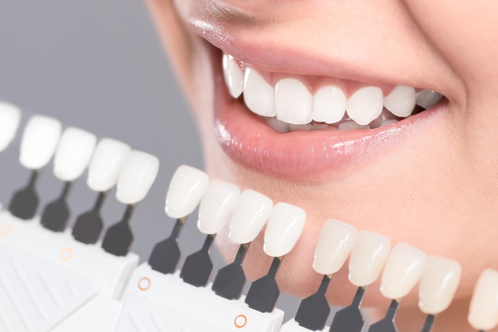 Cosmetic dentistry smile consultation at Patel Dental and Implants